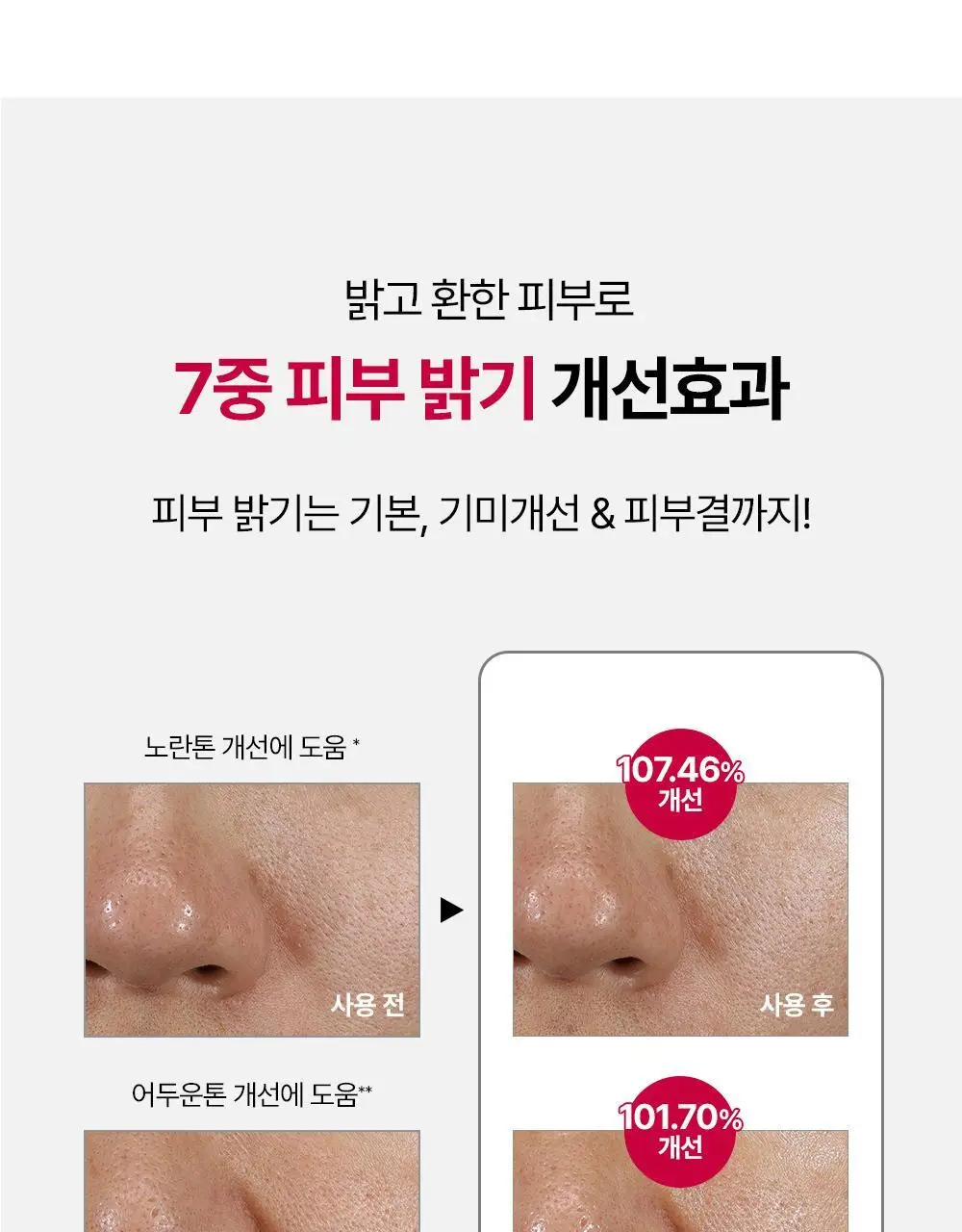 [윤곽앰플] 메디톡스 뉴라덤 코어타임 앰플 15ml [기획(+7ml)/단품] 상세페이지 33
